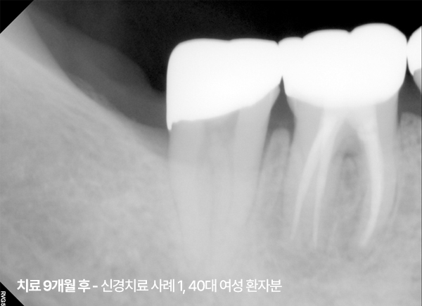 <STRONG>22. 01. 08</STRONG>