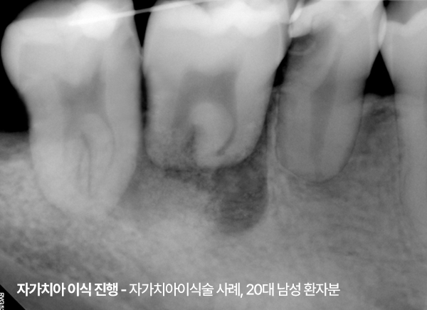 <STRONG>21. 06. 18</STRONG>