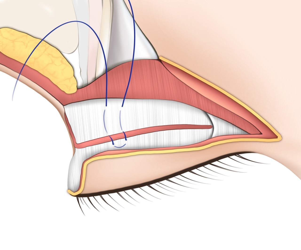 눈 근육 강화 (1)