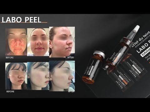 [FULL] Labofill Spicule Tự Nhiên Siêu Nhỏ