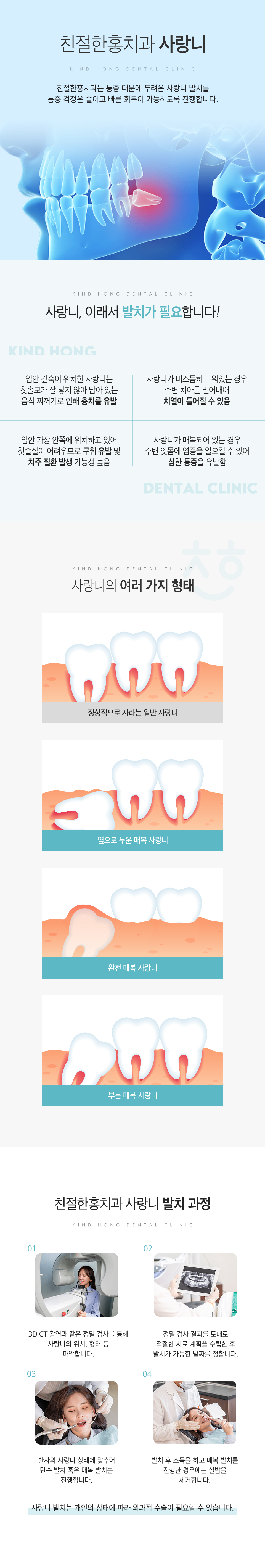친절한홍치과 사랑니