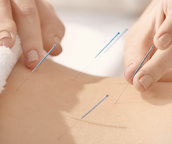 <span style="background-color: #f4f4f4;display:block;padding:14px 0;"><b>침치료</b></span>