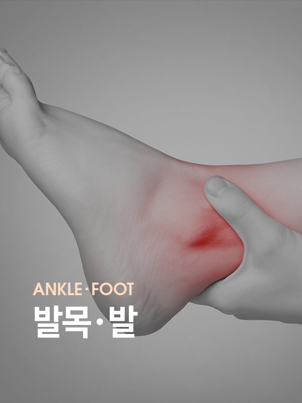 발목, 발 통증을 표현한 사진