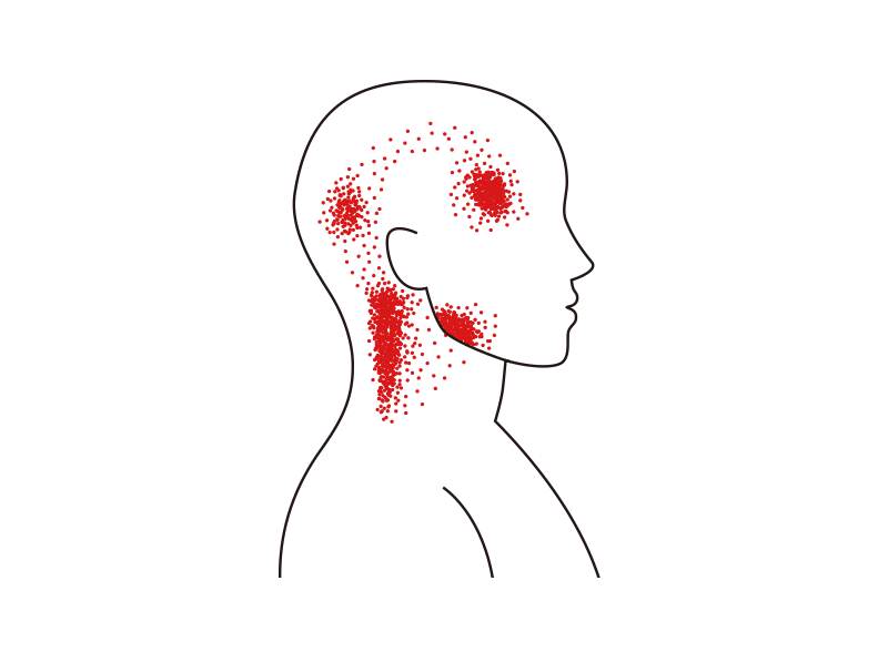 두통 위치를 나타내는 이미지