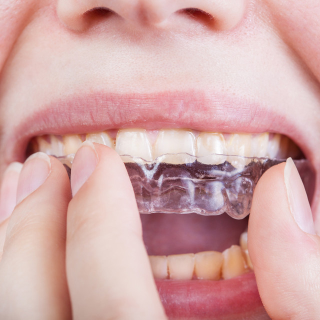 Orthodontic<br><br><span style="font-size:45px; font-weight:600;">치아교정</span>