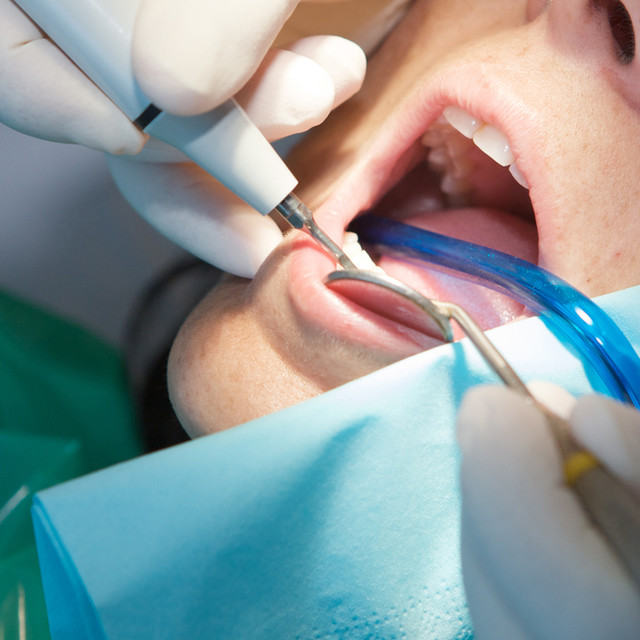 Decayed tooth<br><br><span style="font-size:45px; font-weight:600;">보존치료</span>