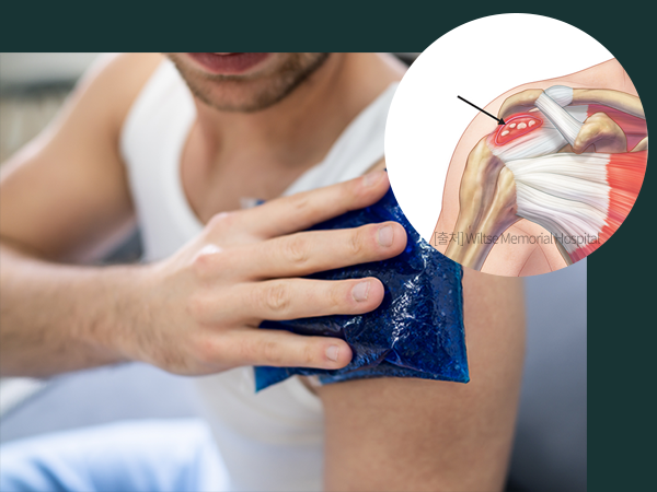 석회성 건염을 나타내는 사진