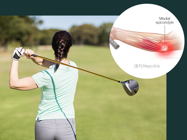 골프를 치고 있는 여성의 사진