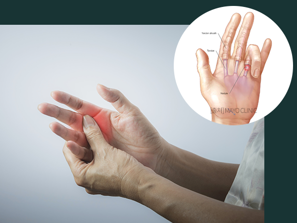 손가락 통증을 느끼고 있는 여성의 사진