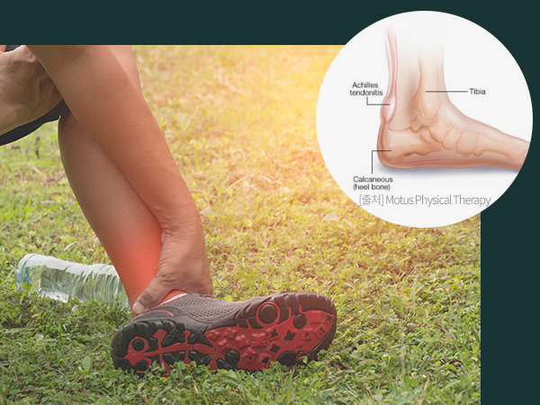 아킬레스 통증을 느끼고 있는 사진