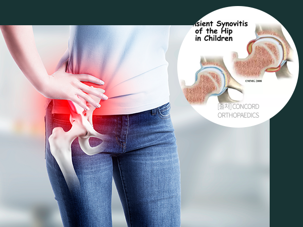 골반 통증으로 아픔을 느끼고 있는 여성의 이미지