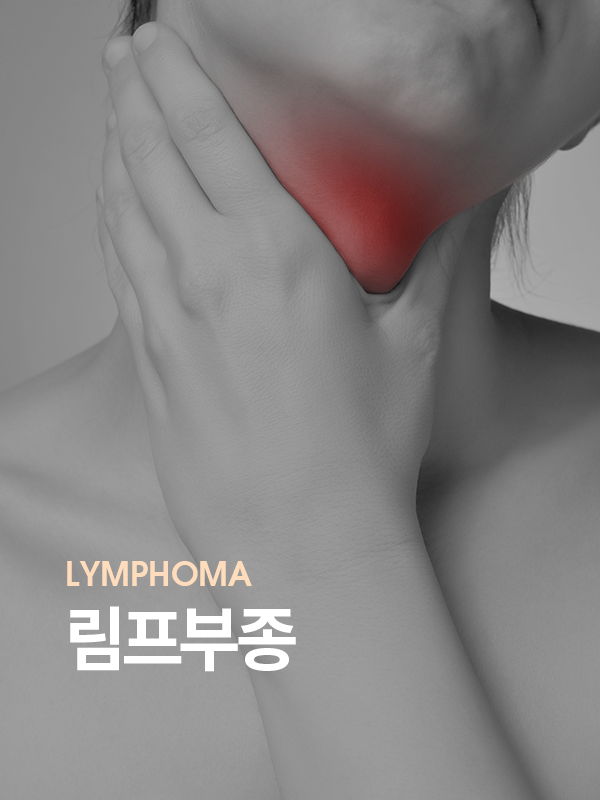 림프부종을 표현한 사진