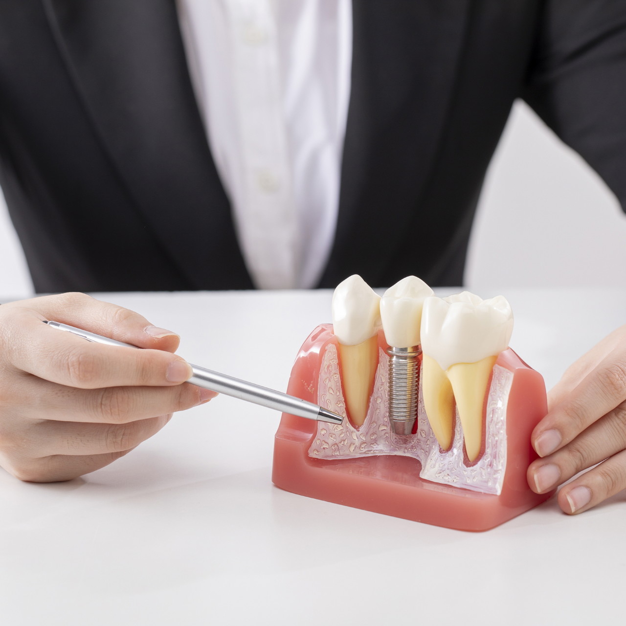 <p class="implant-tit">Accurate positioning</p><p class="implant-tsub">The navigation system helps insert the implant at the correct position and angle, allowing the dentist to predict and adjust the exact position of the implant.</p>