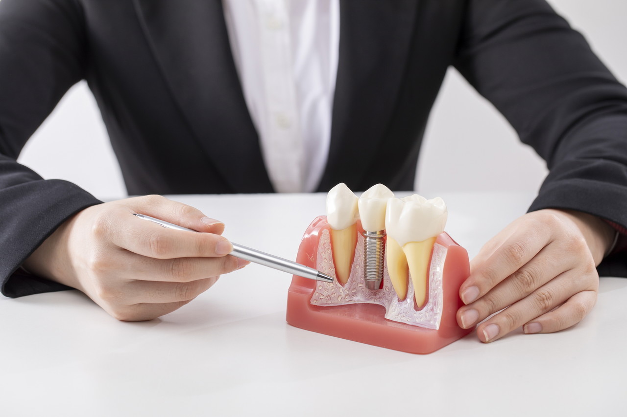 <p class="implant-tit">Fast and comfortable experience</p><p class="implant-tsub"> The navigation system helps insert the implant at the correct position and angle, allowing the dentist to predict and adjust the exact position of the implant.</p>