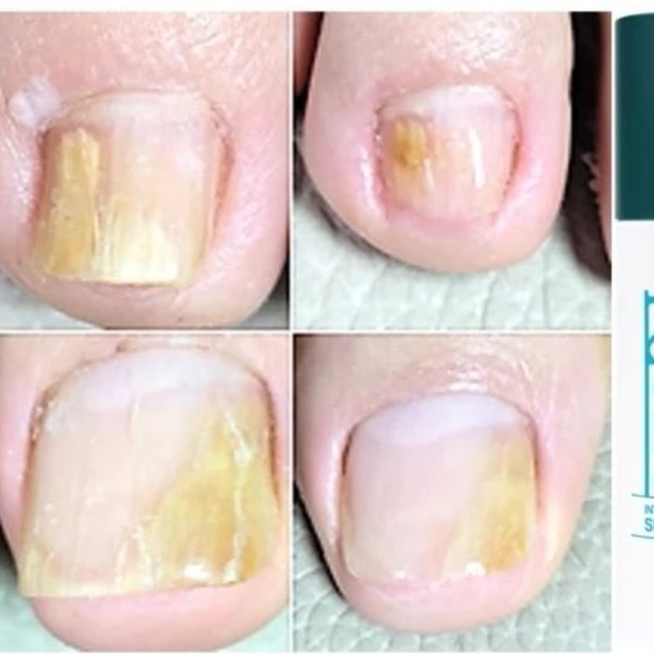 [강원 춘천] 뷰티N뷰티