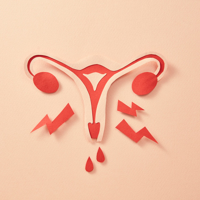 자궁내 노폐물 배출