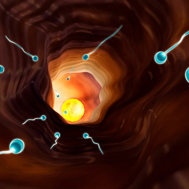 자궁내막 증식유도