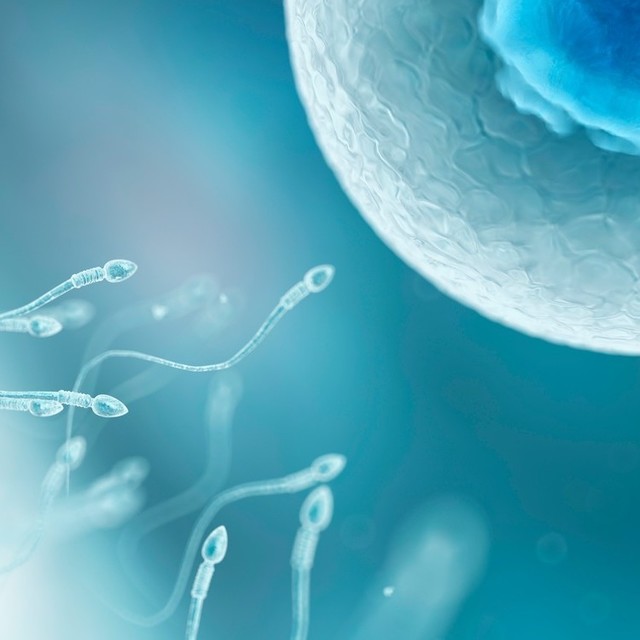 정자의 질 개선