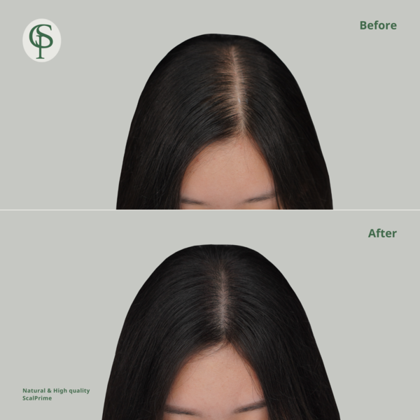 [충남 천안] 스칼프라임