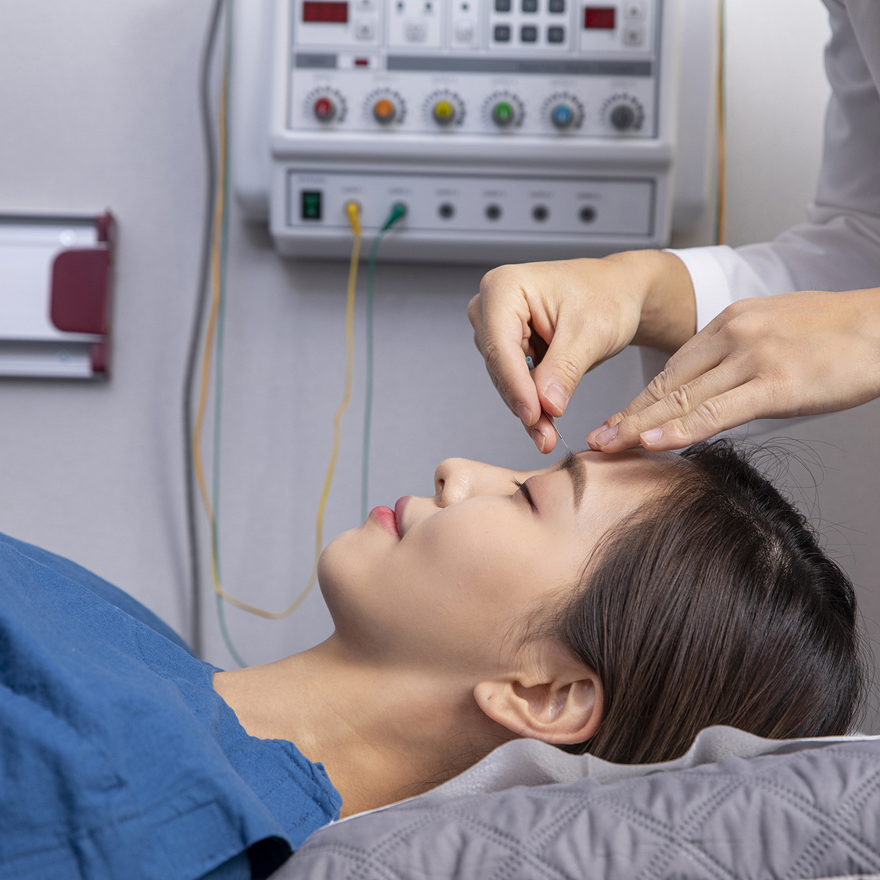안면자극전기침