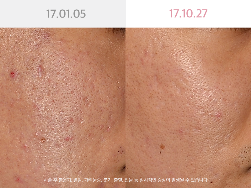 사진을  클릭해주세요↑