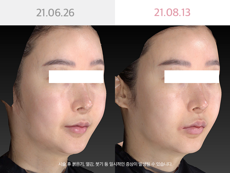 사진을  클릭해주세요↑