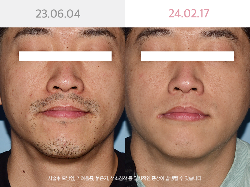 사진을  클릭해주세요↑