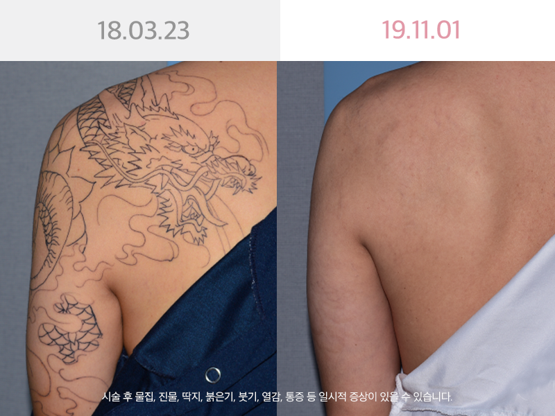 사진을  클릭해주세요↑