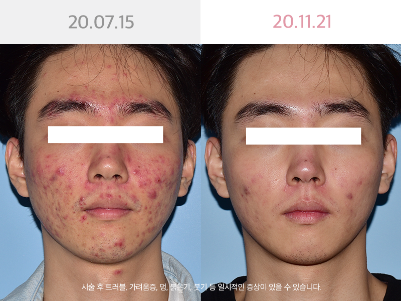 사진을  클릭해주세요↑