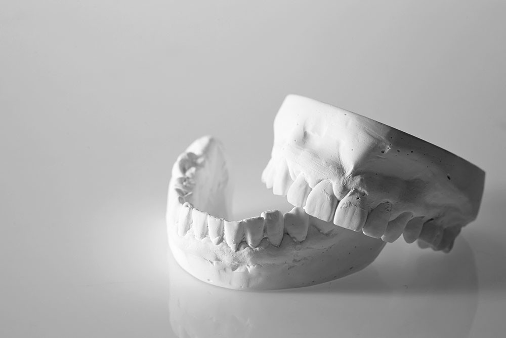 남천동-광안리치과-유엘치과-충치치료-치아모형