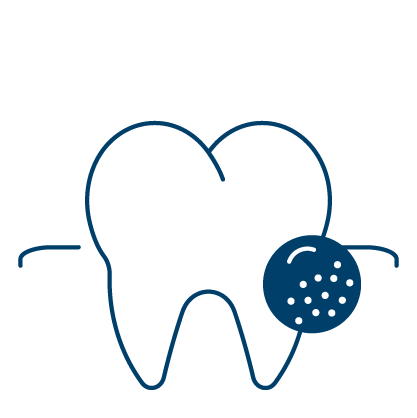 남천동-광안리치과-유엘치과-스케일링-치주질환예방