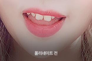 폴리네이트 전