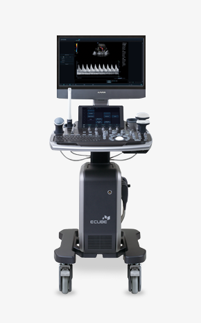 송산두리 이비인후과 e-cube 고해상도 초음파