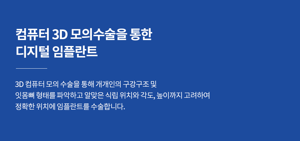 컴퓨터 3D 모의수술을 통한 디지털 임플란트-3D 컴퓨터 모의 수술을 통해 개개인의 구강구조 및  잇몸뼈 형태를 파악하고 알맞은 식립 위치와 각도, 높이까지 고려하여 정확한 위치에 임플란트를 수술합니다.