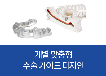 개별 맞춤형 수술 가이드 디자인