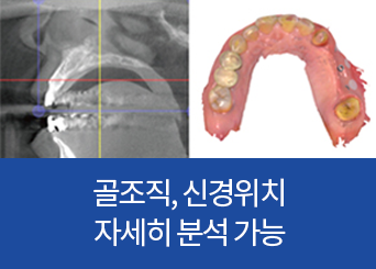 골조직, 신경위치 자세히 분석 가능