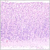 Hematoxylin & Esosin