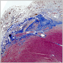 Masson trichrome staining 