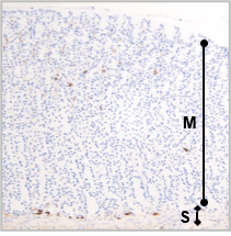 Immunohisto chemistry 