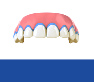 <strong>잇몸 보호제 도포</strong>