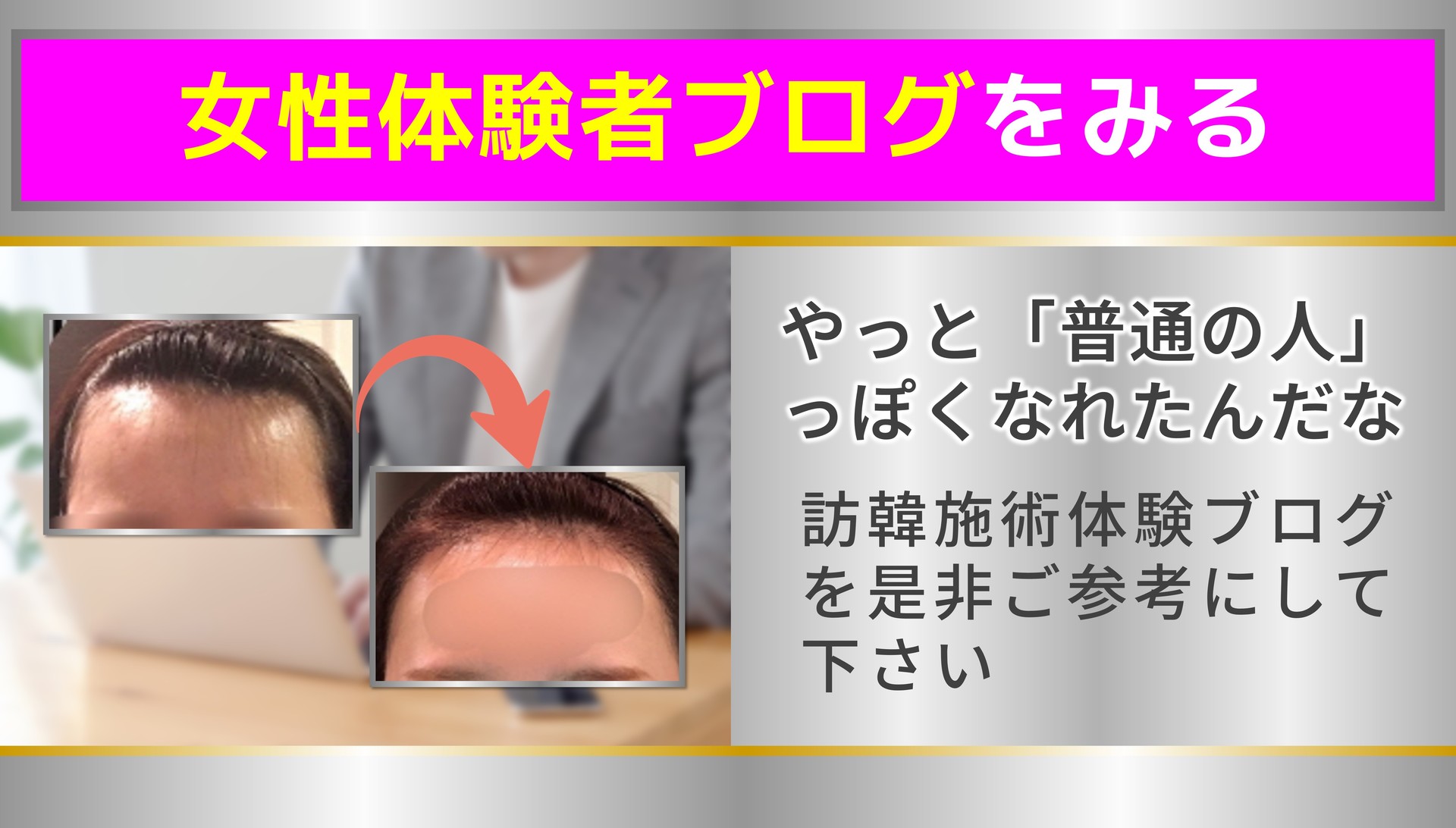 女性体験者ブログをみる やっと「普通の人」 っぽくなれたんだな 訪韓施術体験ブログを是非ご参考にして下さい