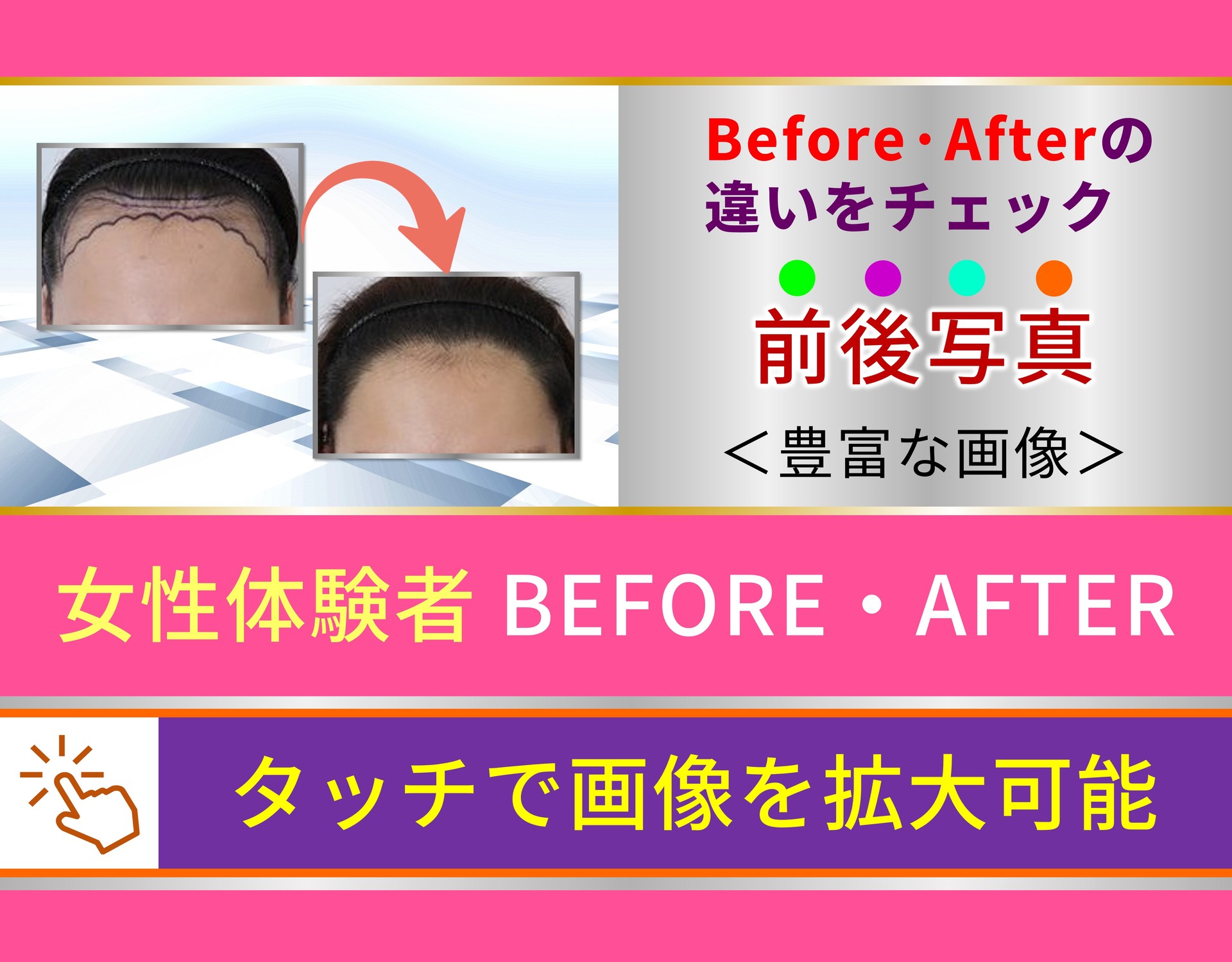 Before·Afterの 違いをチェック 前後写真 ＜豊富な画像＞ 女性体験者 BEFORE・AFTER タッチで画像を拡大可能