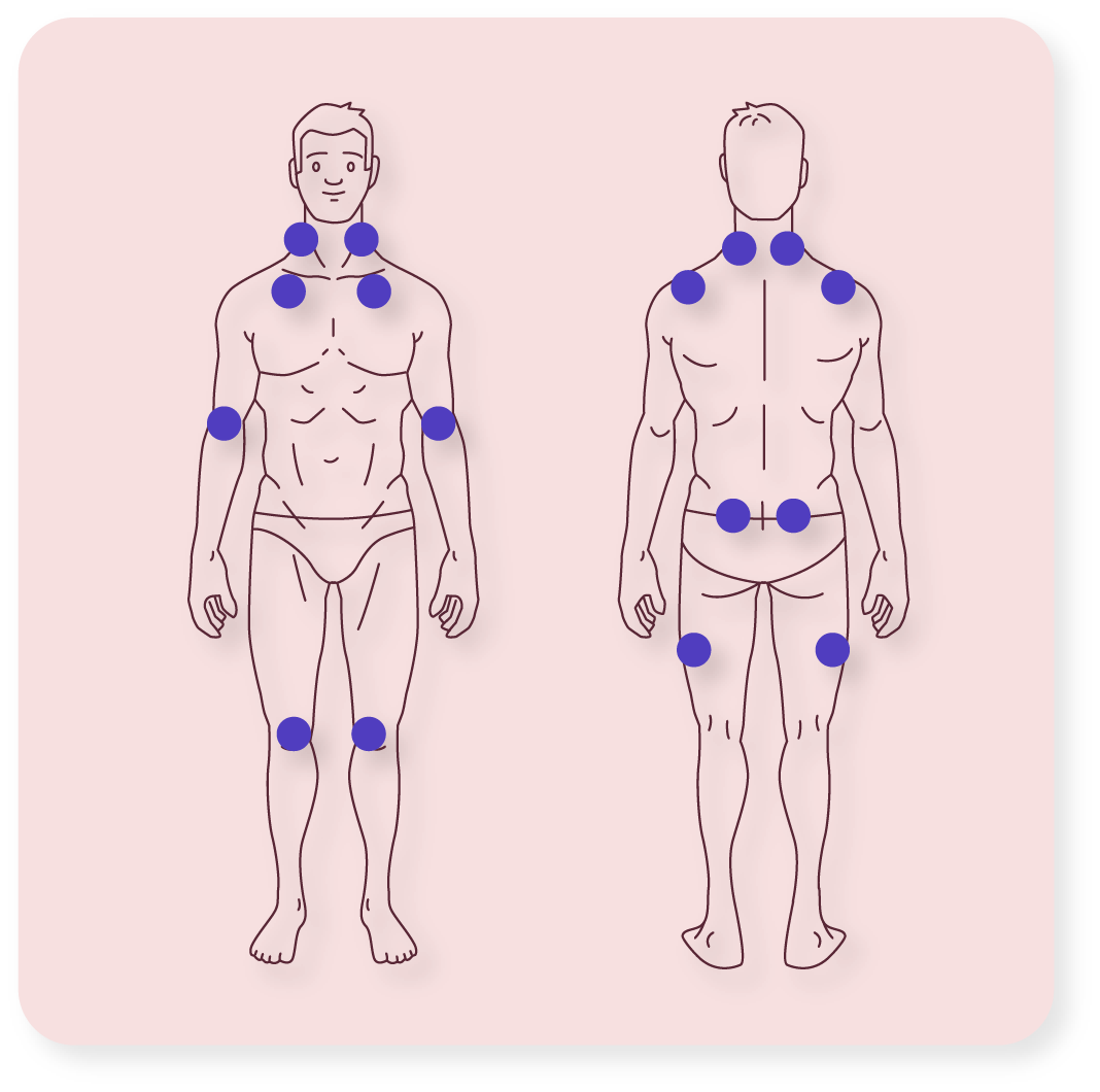<섬유근육통 압통점 18곳>