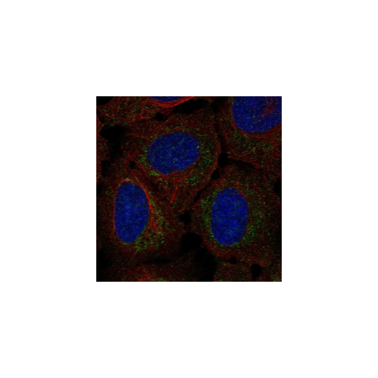 HTD2 Atlas Antibodies : Saintone(주)