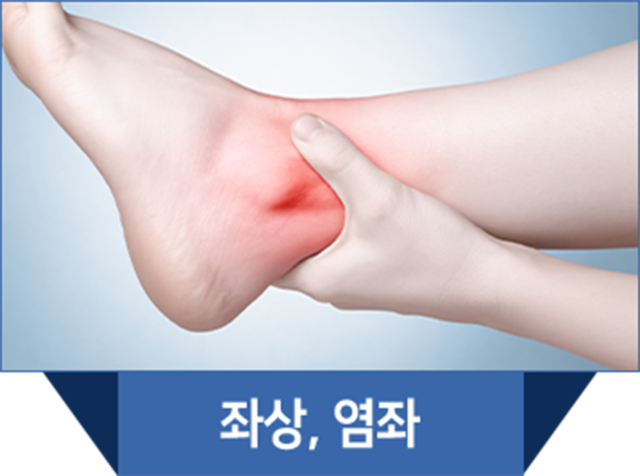 더좋은한방병원 신장분사치료 좌상, 염좌
