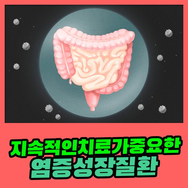 지속적인 치료가 중요한 염증성 장 질환 : 건강검진정보
