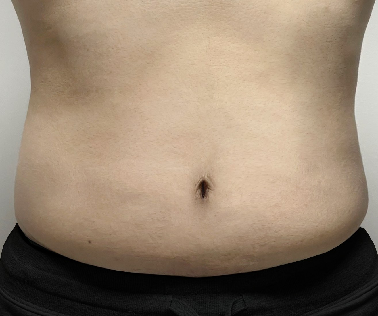 <b><big>-4.7Kg</big><br><small>4주차 81.1kg</small></b>