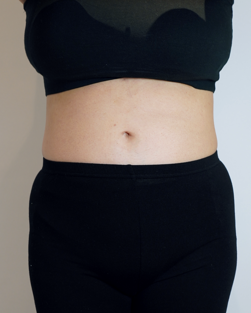 <b><big>-5.6Kg</big><br><small>5주차 74.9kg</small></b>