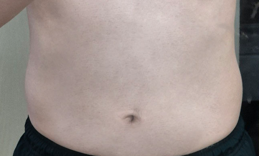 <b><big>-7.0Kg</big><br><small>6주차 93.0kg</small></b>