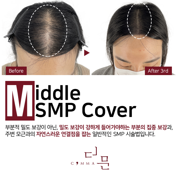 콤마더문